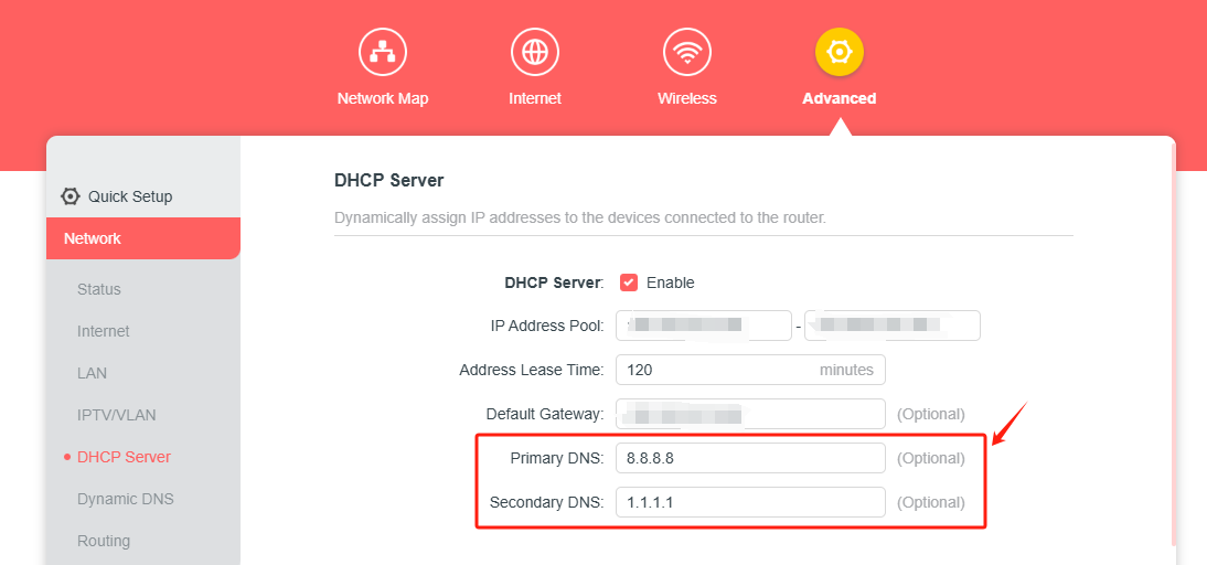 Locate the DNS Setting on the router’s web management page.